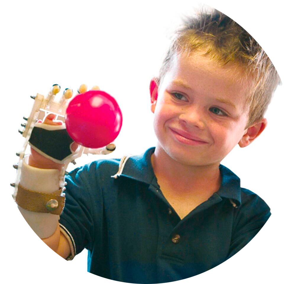 Boy with a prosthetic hand